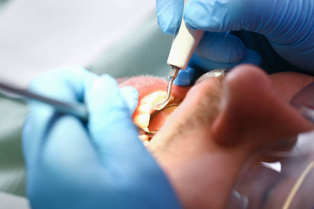 Best Orthodontic Emergency Dentist in Lake Wilderness, VA