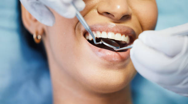 Best Emergency Dentist for Lost Fillings or Crowns in Lake Wilderness, VA